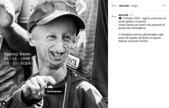 morto-sammy-basso,-il-28enne-italiano-malato-di-progeria