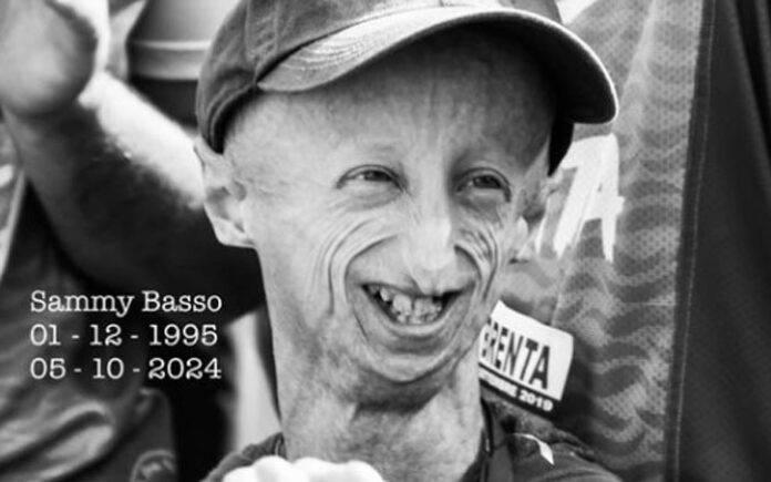 e-morto-sammy-basso,-era-il-piu-longevo-malato-di-progeria-al-mondo