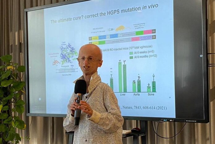 progeria,-cos’e-la-malattia-di-cui-soffriva-sammy-basso